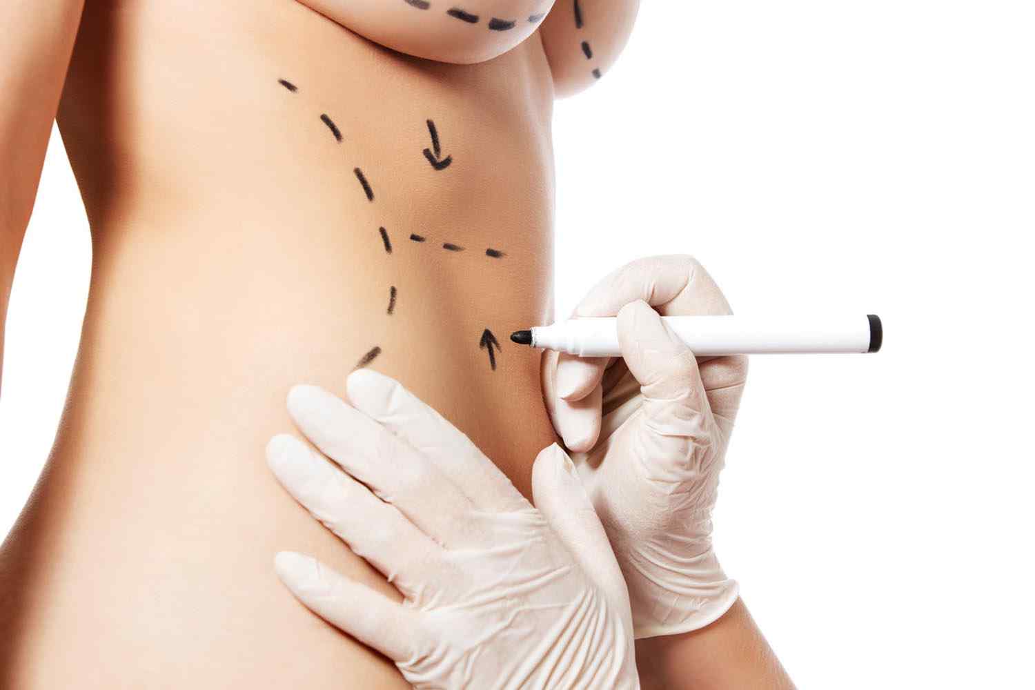 https://www.drmarcogerardi.com/wp-content/uploads/2020/10/cosmetic-surgery-blog-11.jpg